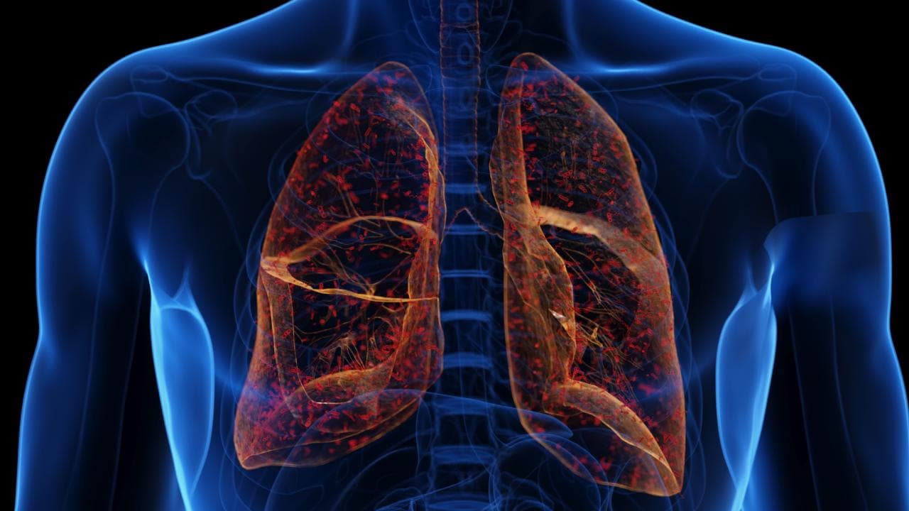 Akciğer vebası nedir ve ne kadar tehlikeli?